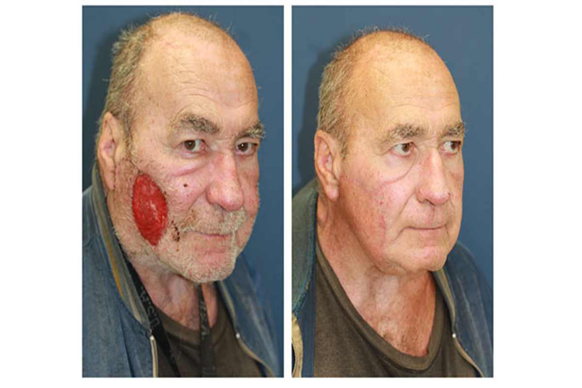 Maxillofacial Surgery