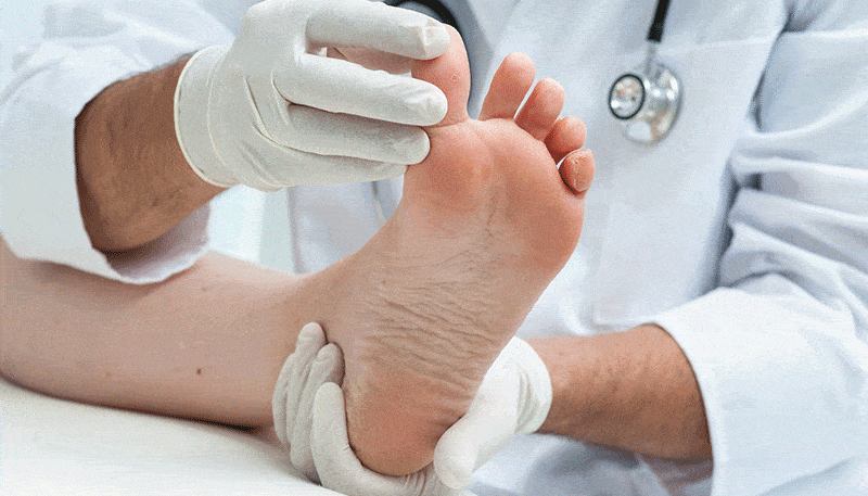Diabetic Foot Surgery