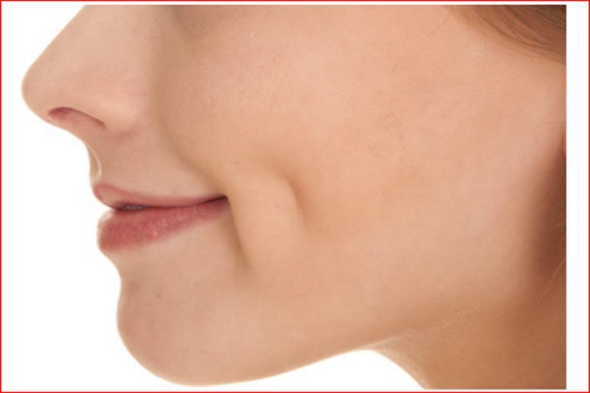 Dimple Creation