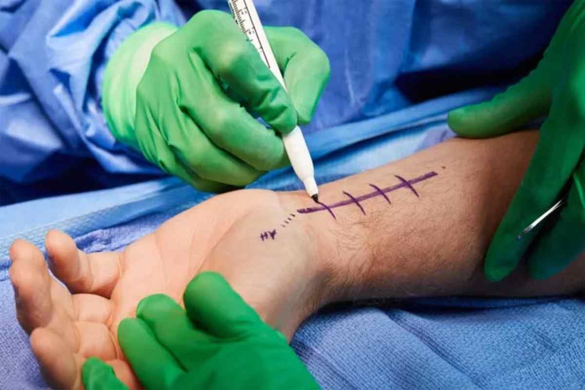 Hand Surgery